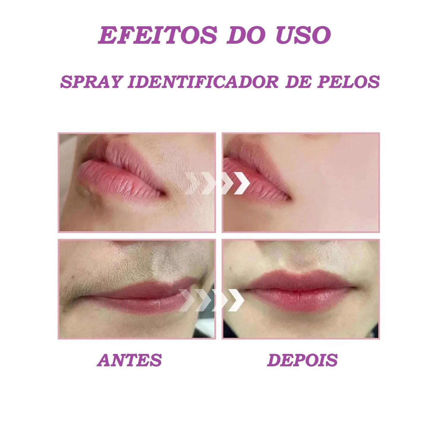 Spray Identificador de Pelos - FastDepil® (Depilação Rápida e 100% Eficiente)
